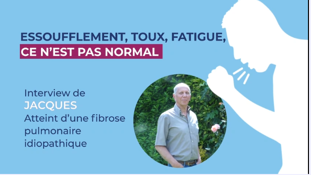 Fibrose Pulmonaire Idiopathique : Symptômes, Diagnostic Et Traitement ...